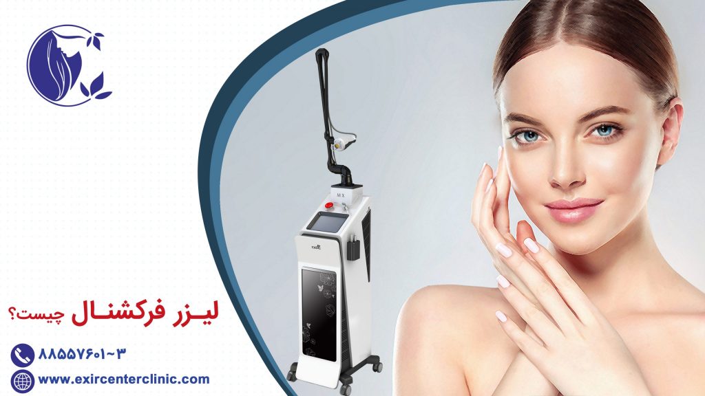 لیزر فرکشنال