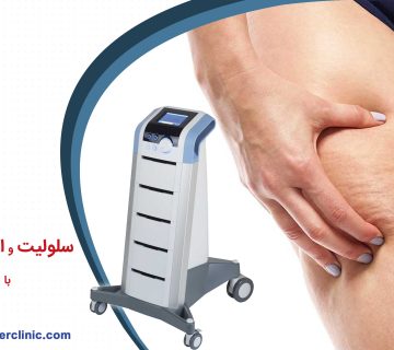 درمان سلولیت و افتادگی پوستی با دستگاه xwave