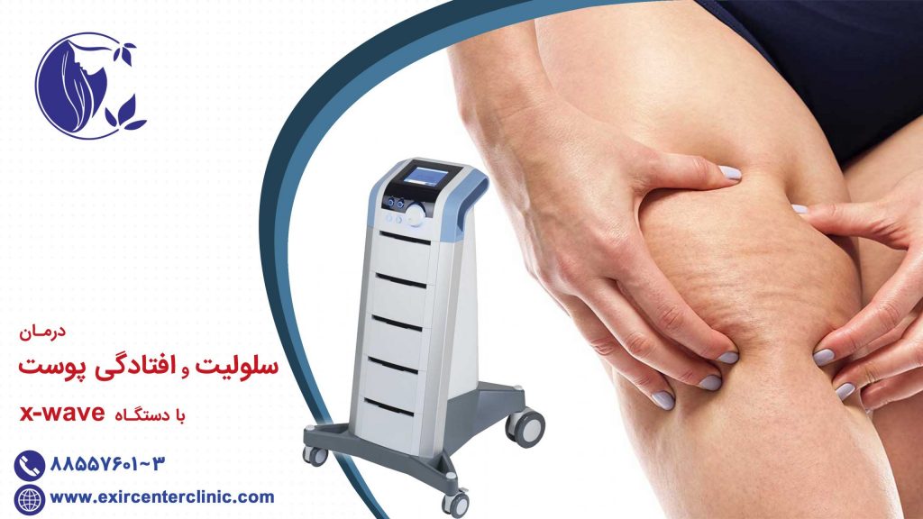 درمان سلولیت و افتادگی پوستی با دستگاه xwave