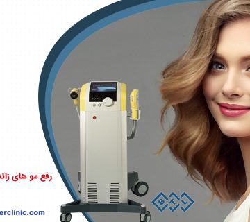 رفع موهای زائد با لیزر IPL