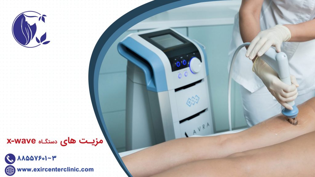 مزیت های دستگاه xwave