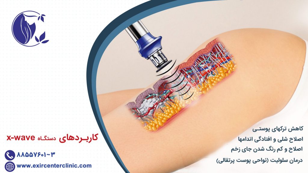 کاربردهای دستگاه xwave