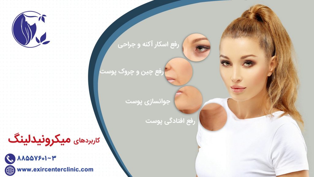 کاربردهای میکرونیدلینگ