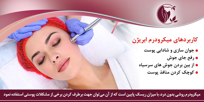 کاربرد میکرودرم