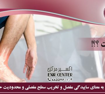آرتروز چیست؟