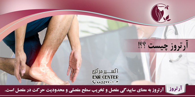 آرتروز چیست؟
