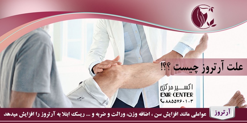 علت آرتروز چیست؟