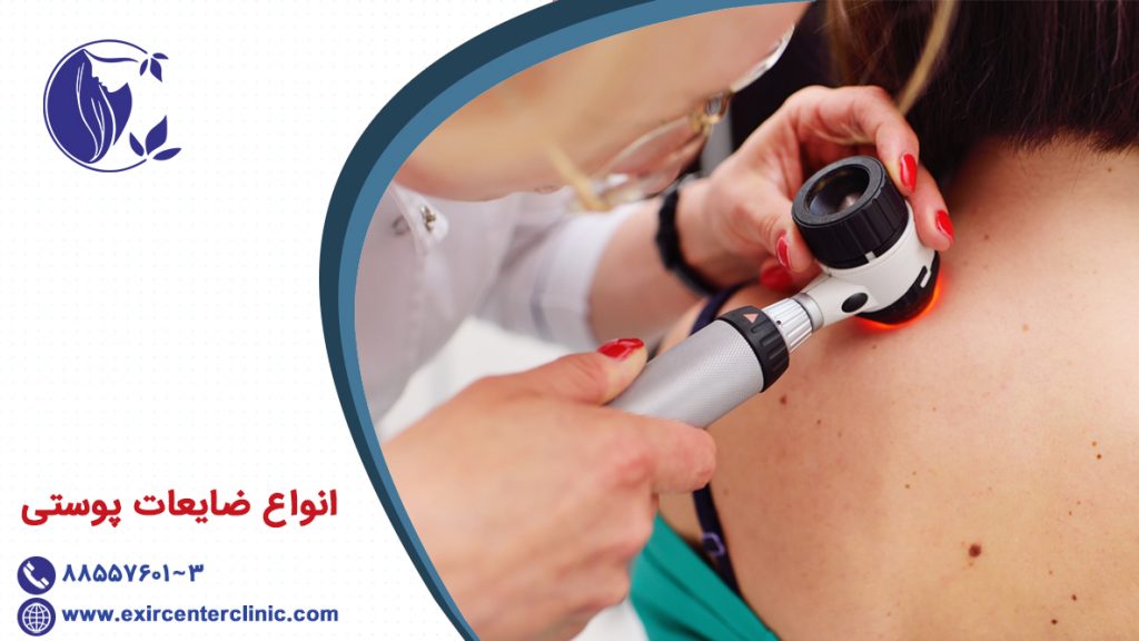 انواع ضایعات پوستی