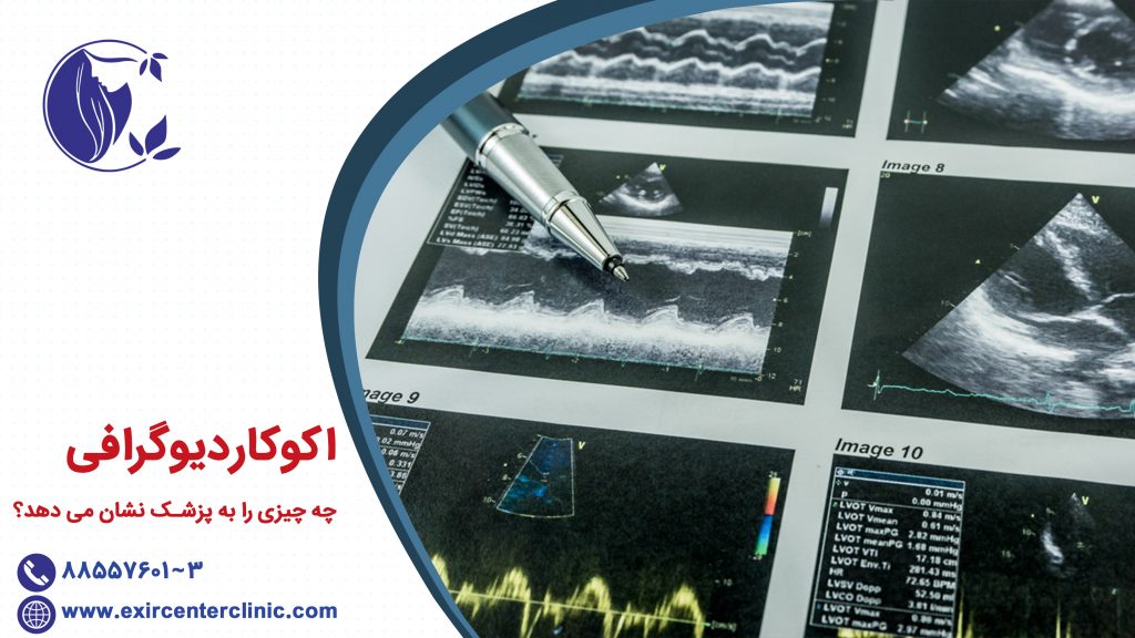 اکوکاردیوگرافی چه چیزی را به پزشک نشان می دهد؟ اکوقلب