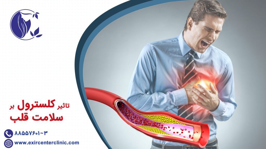 تاثیر کلسترول بر سلامت قلب 
