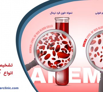 تشخیص و درمان انواع کم خونی
