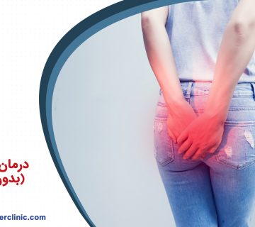 درمان هموروئید بدون جراحی