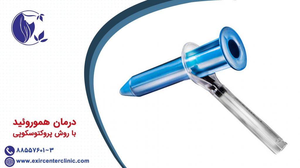 درمان هموروئید یا بواسیر با روش پروکتوسکوپی