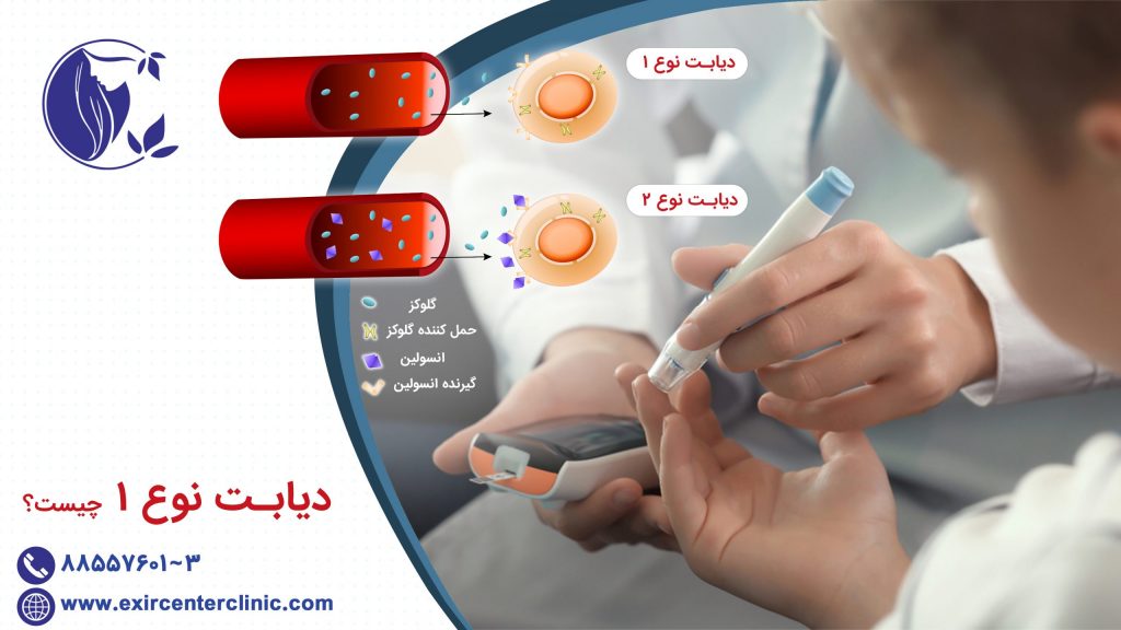 دیابت نوع 1