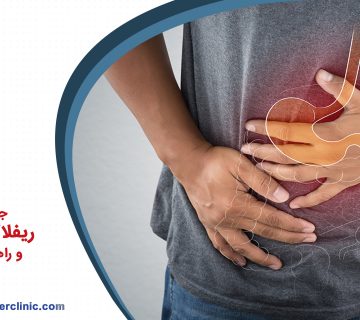 جلوگیزی از ریفلاکس معده و راهکار های آن