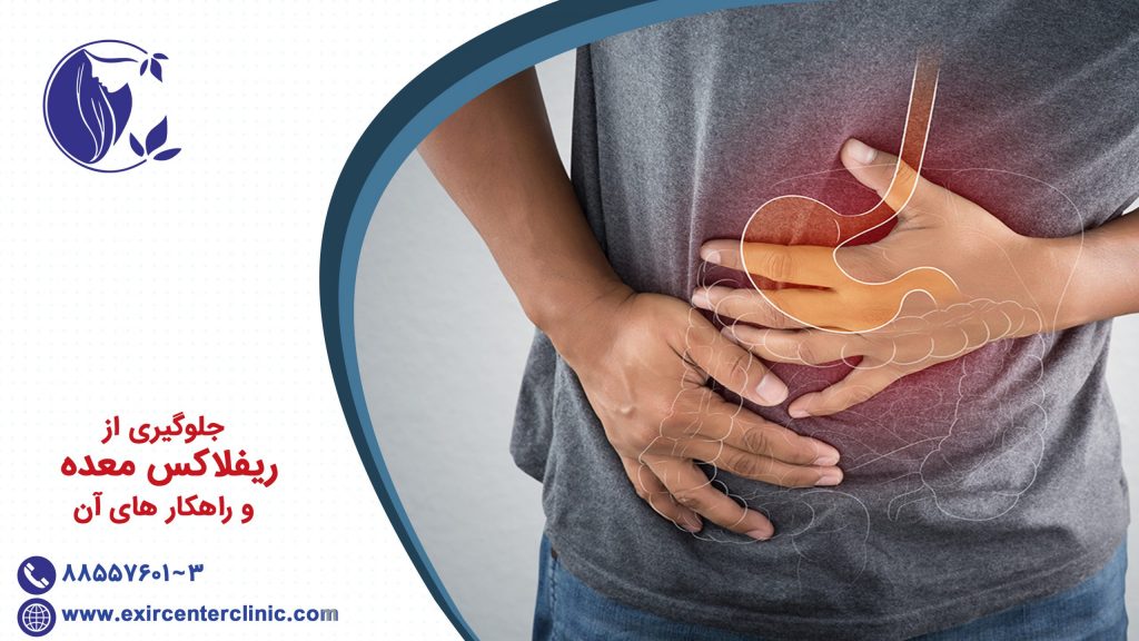 جلوگیزی از ریفلاکس معده و راهکار های آن