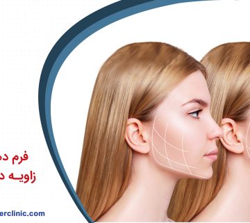 فرم دهی به صورت و زاویه دار کردن فک