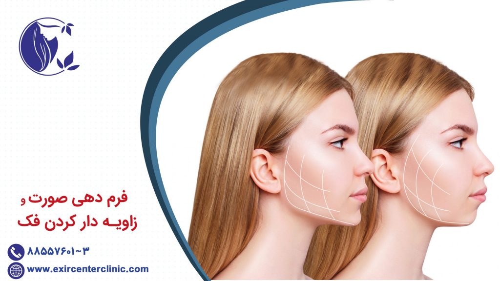 فرم دهی به صورت و زاویه دار کردن فک