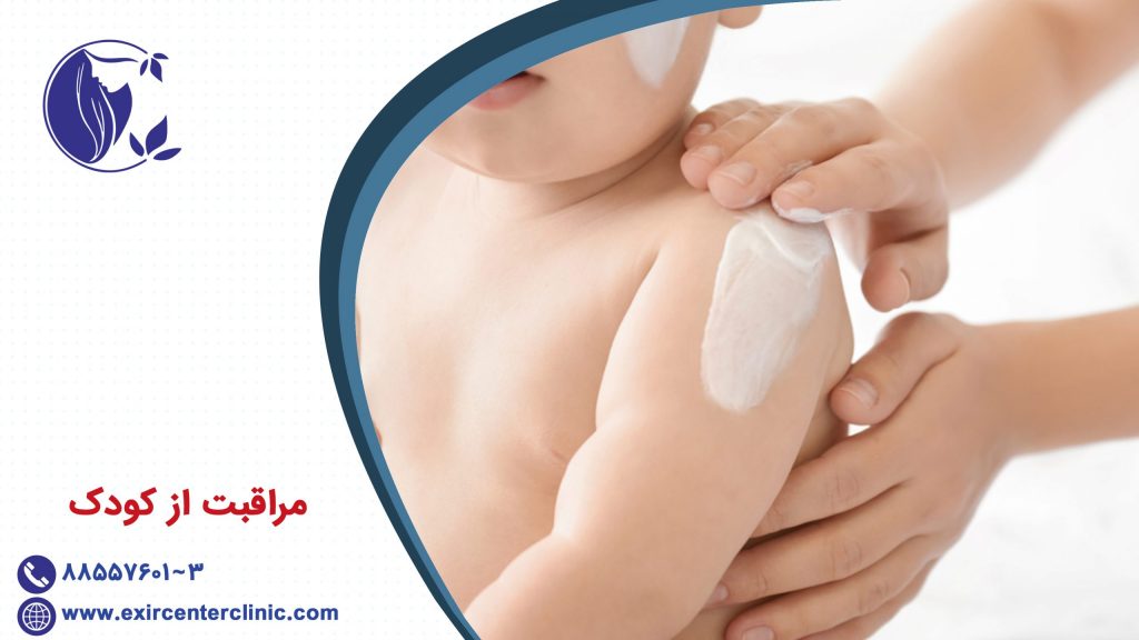 مراقبت از کودک