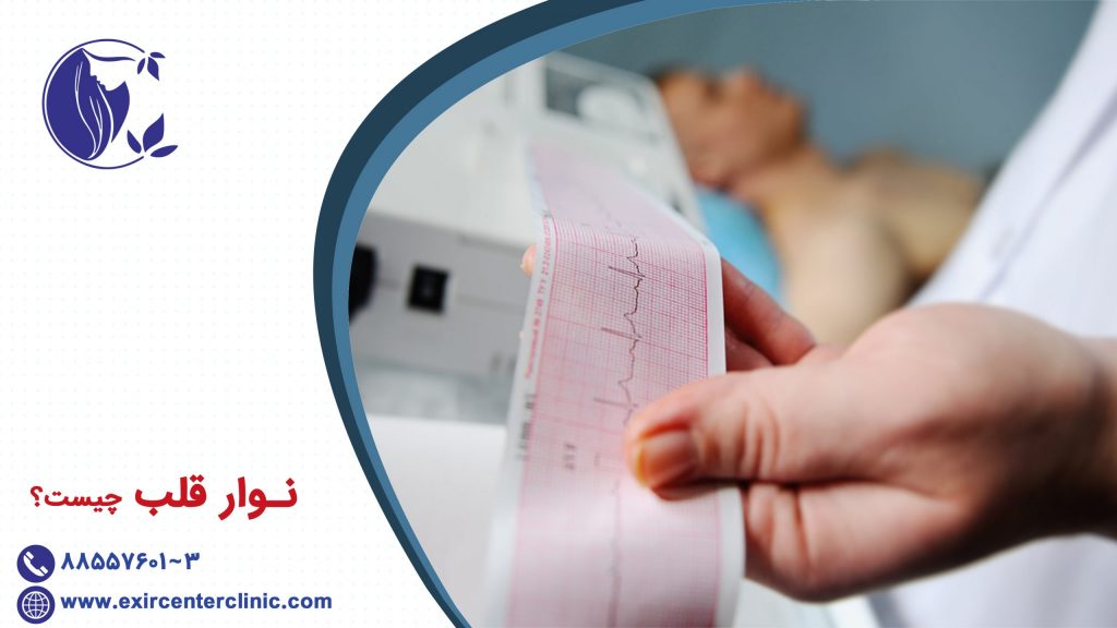 نوار قلب چیست؟