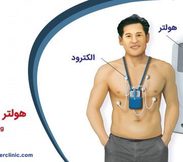 هولتر مانیتورینگ