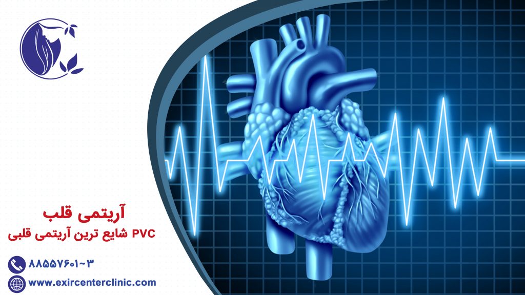 آریتمی قلب PVC شایع ترین آریتمی قلبی
