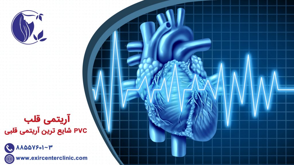 آریتمی قلب PVC شایع ترین آریتمی قلبی