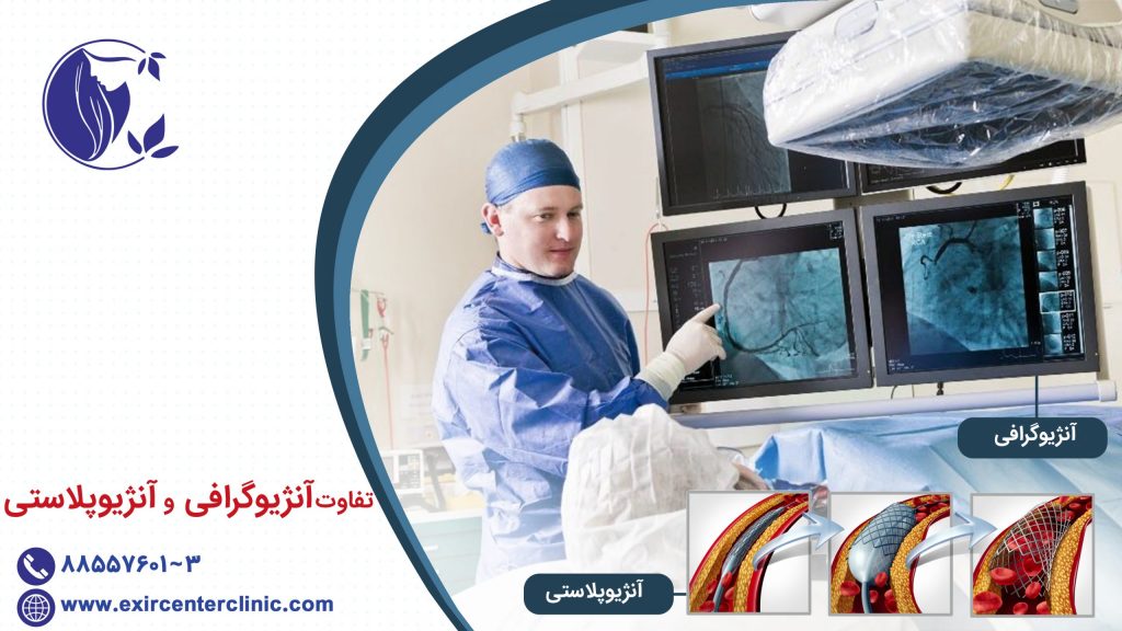 تفاوت آنژیوگرافی و آنژیوپلاستی