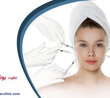 تفاوت بوتاکس و فیلر