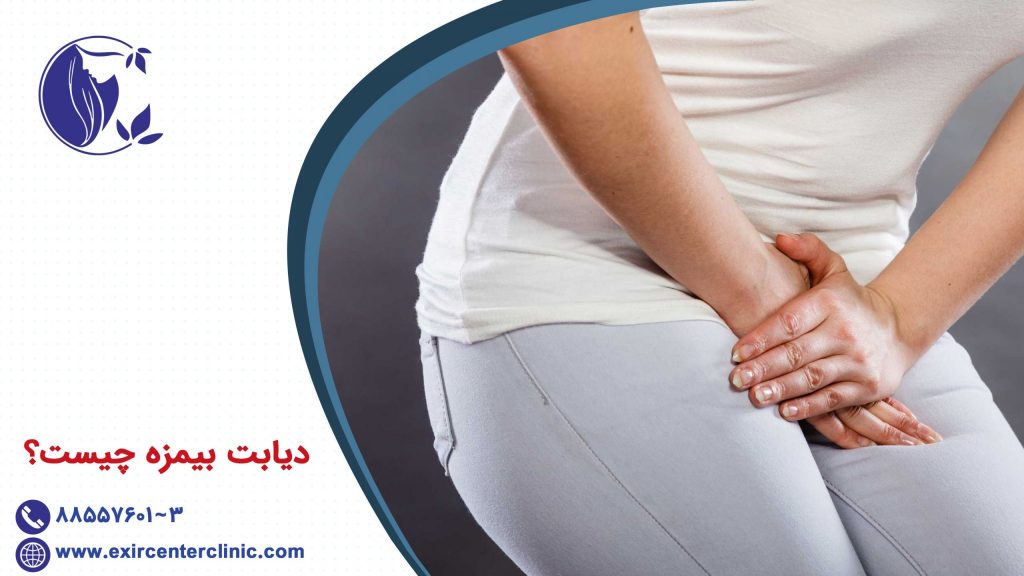 ديابت بيمزه چيست؟