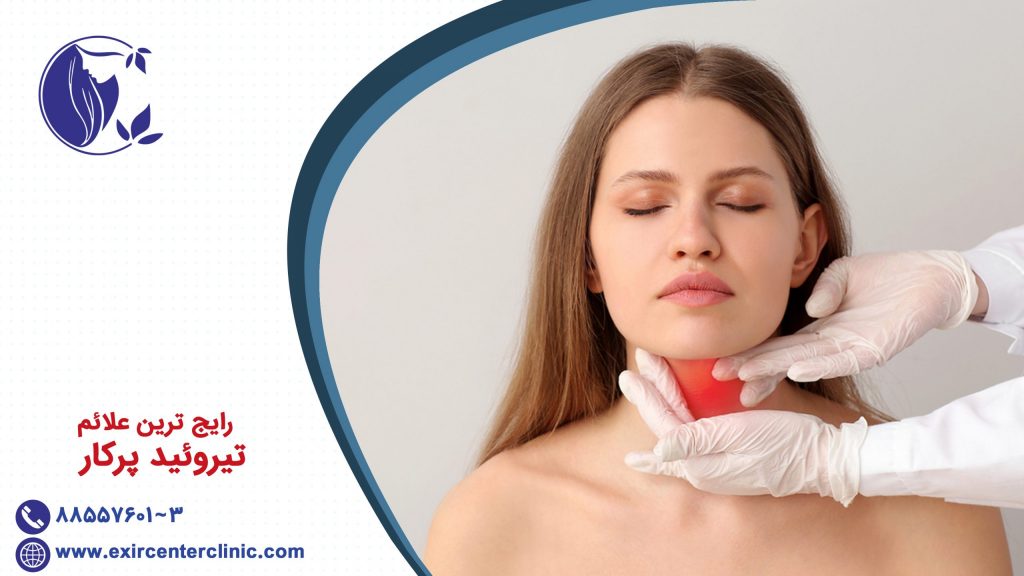 رایج ترین علائم تیروئید پکار تیروئید