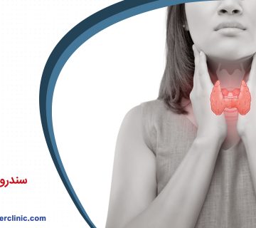 سندروم گریوز چیست؟