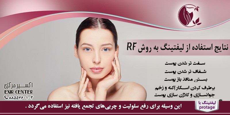 نتایج استفاده از لیفتینگ به روش RF