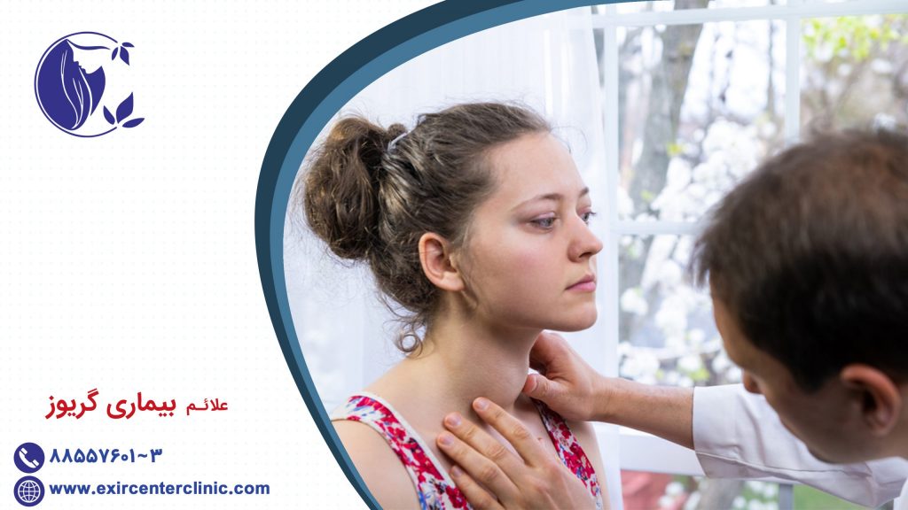 علائم بیماری گریوز