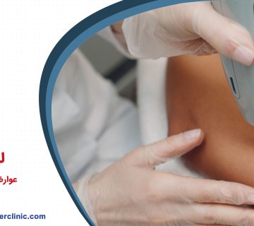 لیزر موهای زائد