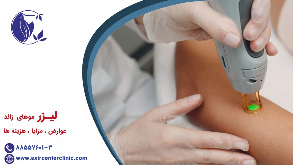 لیزر موهای زائد