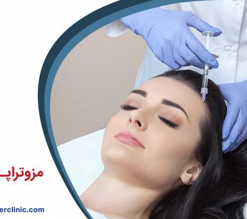 مزوتراپی مو چیست؟