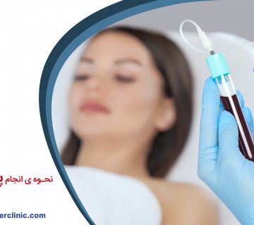 نحوه انجام پی آر پی (PRP)