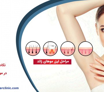 نکات مهمی که باید در مورد لیزر بدانید