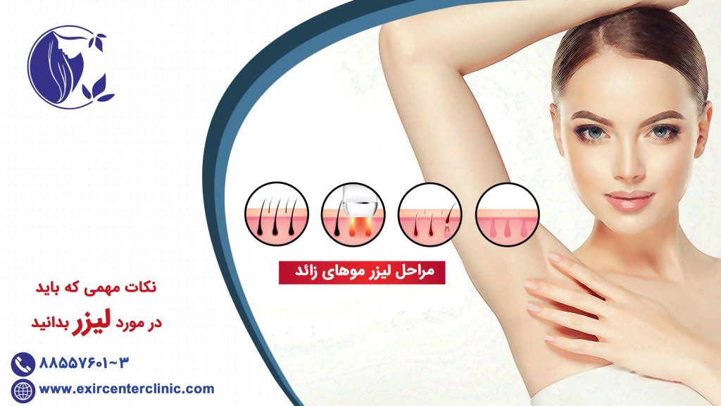 نکات مهمی که باید در مورد لیزر بدانید