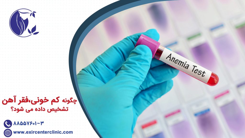 چگونه کم خونی فقر آهن تشخیص داده می شود؟
