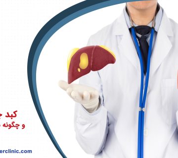 کبد چرب چیست و چگونه به وجود می آید؟