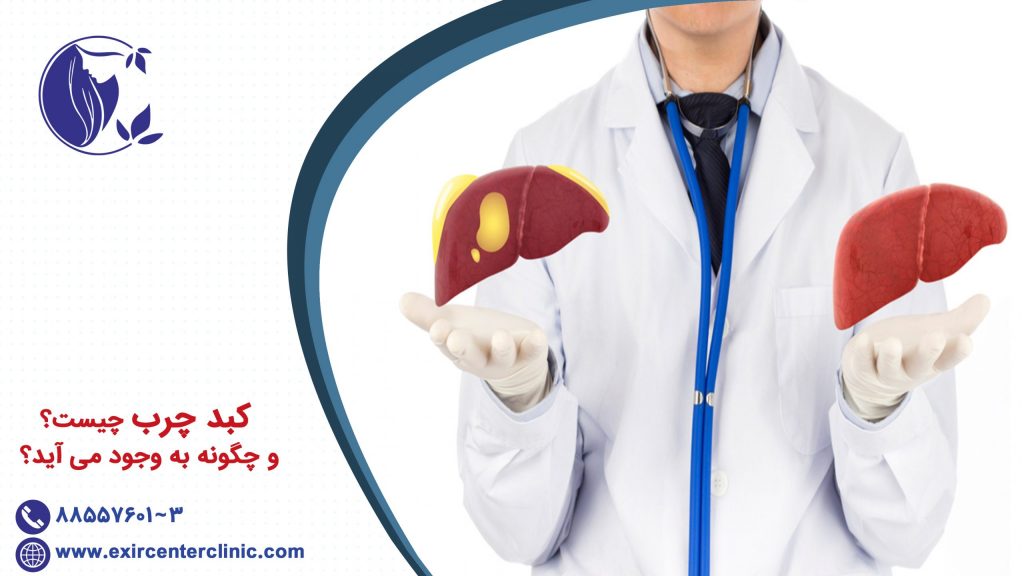 کبد چرب چیست و چگونه به وجود می آید؟