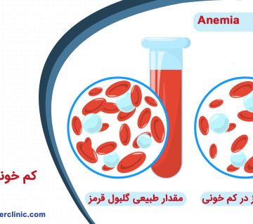 کم خونی فقر آهن