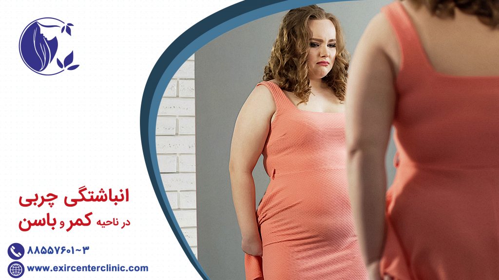 انباشتگی چربی در ناحیه کمر و باسن