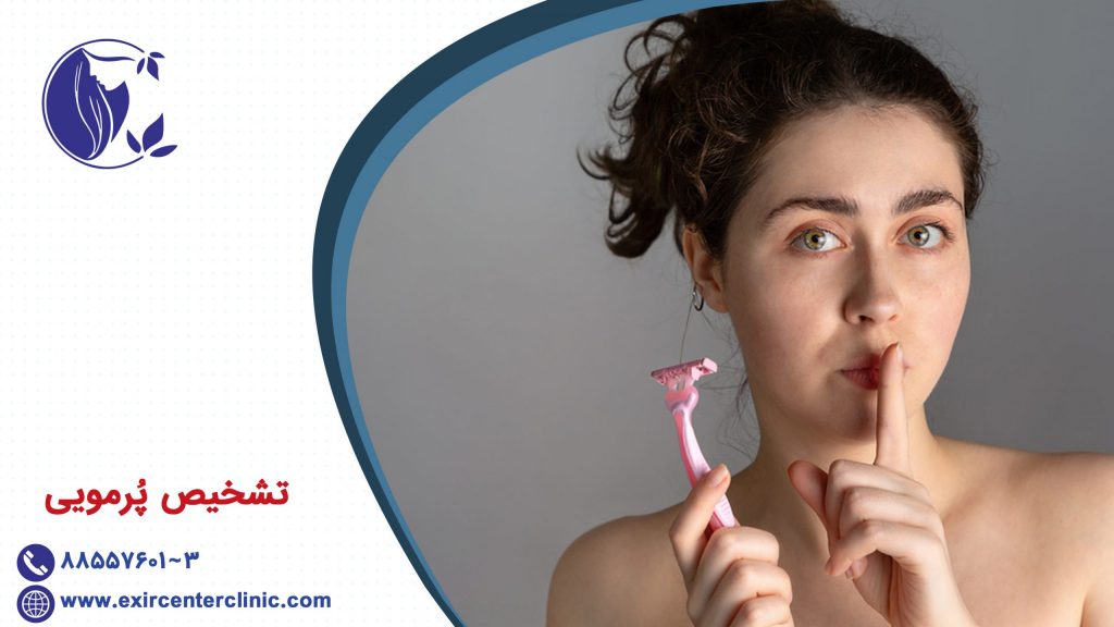 تشخیص پُرمویی