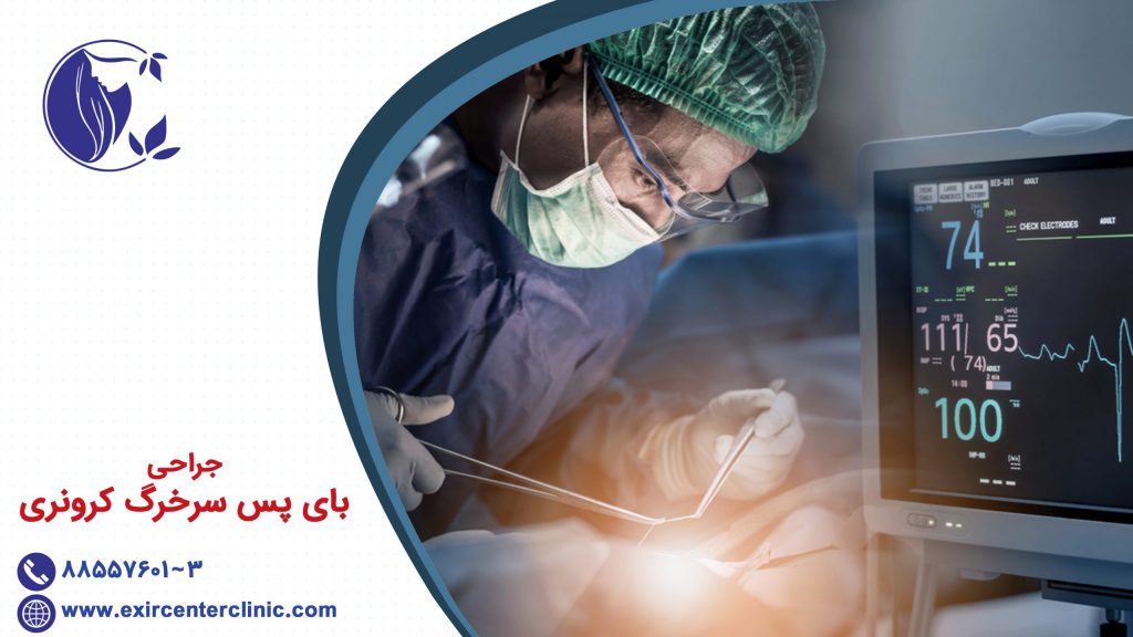 جراحی بای پس سرخرگ کرونری