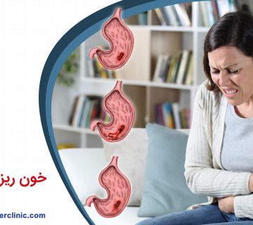 خون ریزی گوارشی