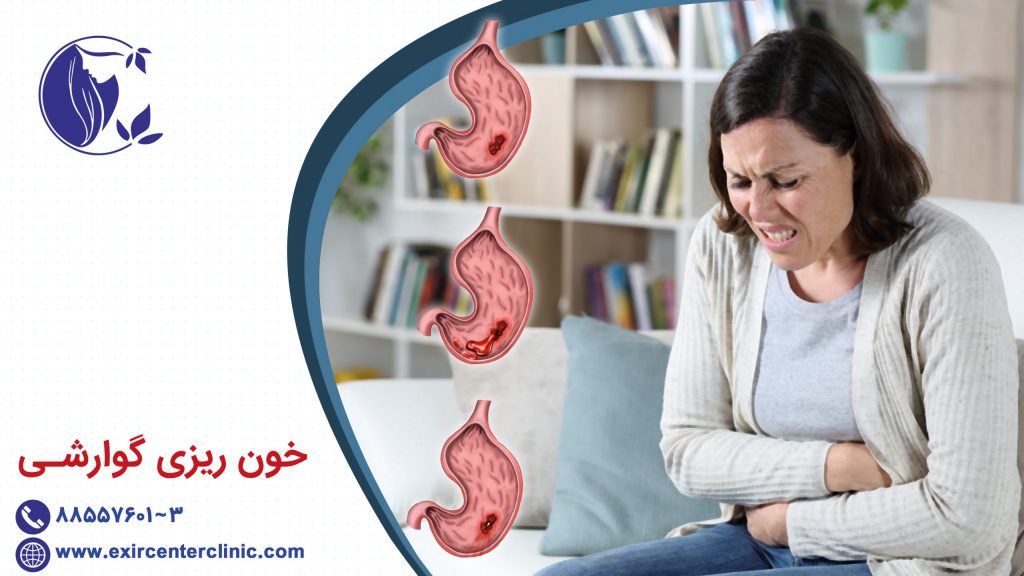 خون ریزی گوارشی