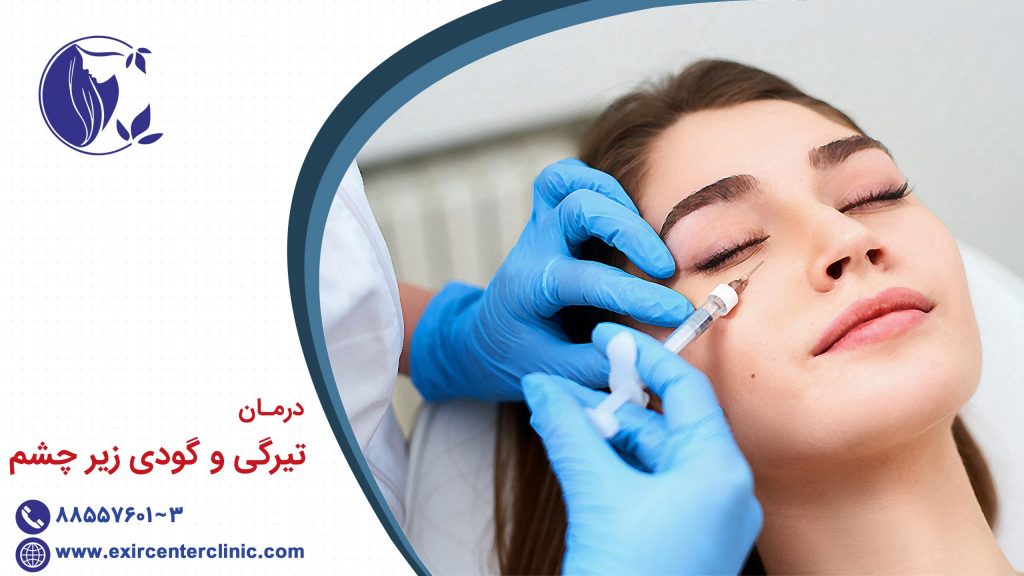 درمان تیرگی و گودی زیر چشم
